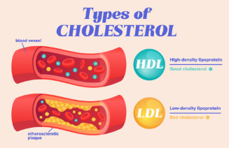 Photo of Unmasking the HDL ‘Good’ Cholesterol’s Sneaky Link to Dementia Risk