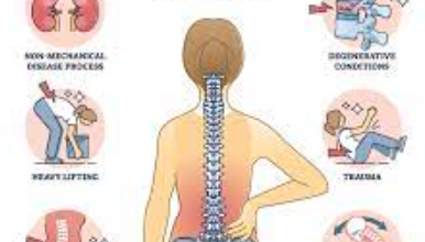 Easing Lower Back Pain: Expert Advice in 3 Simple Steps